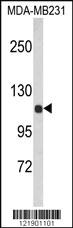 Anti-ULK3 Rabbit Polyclonal Antibody