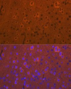 Immunofluorescence analysis of mouse brain cells using Anti-DCAMKL1 Antibody (A12365) at a dilution of 1:100 (40X lens). DAPI was used to stain the cell nuclei (blue)