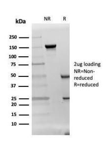 SDS-PAGE analysis of Anti-DAZL Antibody [DAZL/4253] under non-reduced and reduced conditions; showing intact IgG and intact heavy and light chains, respectively. SDS-PAGE analysis confirms the integrity and purity of the antibody