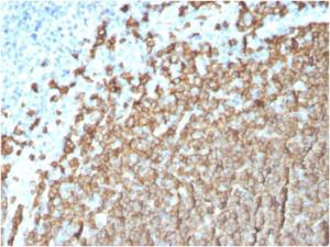 Immunohistochemical analysis of formalin-fixed, paraffin-embedded human tonsil using Anti-CD20 Antibody [MS4A1/3411]