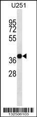 Anti-CD320 Rabbit Polyclonal Antibody (Biotin)