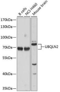 Western blot analysis of extracts of various cell lines, using Anti-UBQLN2 Antibody (A12376) at 1:1,000 dilution The secondary antibody was Goat Anti-Rabbit IgG H&L Antibody (HRP) at 1:10,000 dilution Lysates/proteins were present at 25 µg per lane