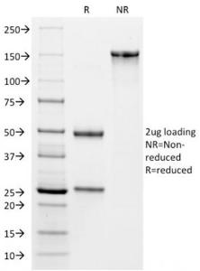 SDS-PAGE analysis of Anti-VISTA Antibody [VISTA/2864] under non-reduced and reduced conditions; showing intact IgG and intact heavy and light chains, respectively. SDS-PAGE analysis confirms the integrity and purity of the Antibody