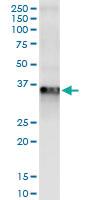 Anti-RLBP1 Polyclonal Antibody Pair