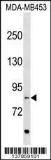 Anti-EVI5L Rabbit Polyclonal Antibody (AP (Alkaline Phosphatase))