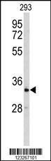 Anti-CRELD2 Rabbit Polyclonal Antibody (FITC (Fluorescein Isothiocyanate))