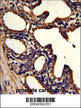 Anti-LTF Mouse Monoclonal Antibody [clone: 119CT80.1.1]