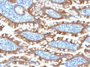 Immunohistochemical analysis of formalin-fixed, paraffin-embedded human small intestine using Anti-Cytokeratin 8 Antibody [KRT8/2174R]