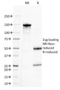 SDS-PAGE analysis of Anti-CD20 Antibody [MS4A1/3411] under non-reduced and reduced conditions; showing intact IgG and intact heavy and light chains, respectively SDS-PAGE analysis confirms the integrity and purity of the antibody