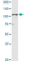 Anti-NDST4 Rabbit Polyclonal Antibody