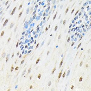 Immunohistochemistry analysis of paraffin-embedded human esophageal using Anti-SLBP Antibody (A308103) at a dilution of 1:100 (40X lens). Perform microwave antigen retrieval with 10 mM Tris/EDTA buffer pH 9.0 before commencing with IHC staining protocol