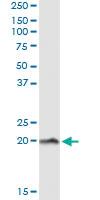 Anti-NPC2 Antibody Pair