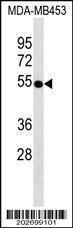 Anti-VDR Mouse Monoclonal Antibody [clone: 517CT23.5.1]