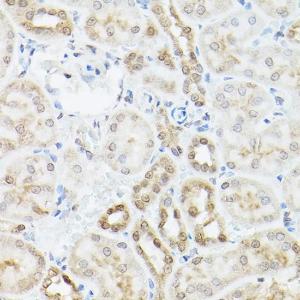 Immunohistochemistry analysis of paraffin-embedded mouse kidney using Anti-UBQLN2 Antibody (A12376) at a dilution of 1:200 (40x lens) Perform high pressure antigen retrieval with 10 mM citrate buffer pH 60 before commencing with IHC staining protocol