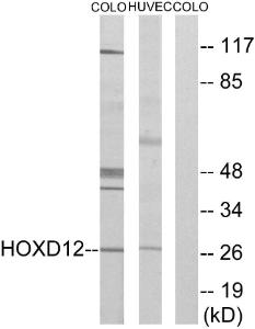 Western blot analysis of lysates from COLO205 and HucEc cells, treated with serum 20% 15' using Anti-HOXD12 Antibody. The right hand lane represents a negative control, where the Antibody is blocked by the immunising peptide