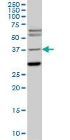 Anti-ISL1 Mouse Monoclonal Antibody [clone: 2E7]