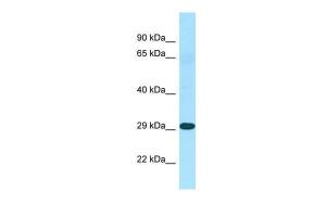 Anti-NSA2 Rabbit Polyclonal Antibody