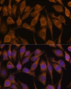 Immunofluorescence analysis of HeLa cells using Anti-UBQLN2 Antibody (A12376) at a dilution of 1:100 (40x lens) DAPI was used to stain the cell nuclei (blue)