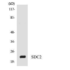 Western blot analysis of the lysates from RAW264.7 cells using Anti-SDC2 Antibody