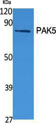 Western blot analysis of various cells using Anti-PAK7 Antibody