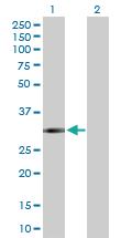 Anti-FCN3 Rabbit Polyclonal Antibody