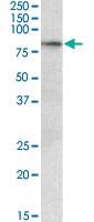 Anti-TP63 Goat Polyclonal Antibody