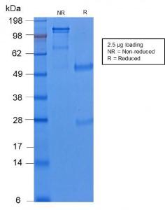 SDS-PAGE analysis of Anti-Cytokeratin 8 Antibody [KRT8/2174R] under non-reduced and reduced conditions; showing intact IgG and intact heavy and light chains, respectively. SDS-PAGE analysis confirms the integrity and purity of the antibody