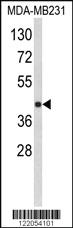 Anti-HOXA11 Rabbit Polyclonal Antibody