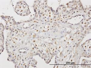 Anti-STK33 Mouse Monoclonal Antibody [clone: 3F10]