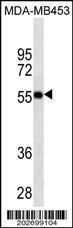 Anti-VDR Mouse Monoclonal Antibody [clone: 517CT23.5.1]