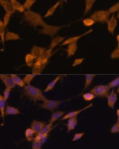 Immunofluorescence analysis of NIH-3T3 cells using Anti-UBQLN2 Antibody (A12376) at a dilution of 1:100 (40x lens) DAPI was used to stain the cell nuclei (blue)