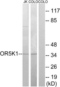 Western blot analysis of lysates from COLO and Jurkat cells using Anti-OR5K1 Antibody. The right hand lane represents a negative control, where the antibody is blocked by the immunising peptide