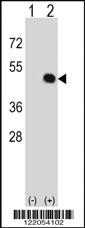 Anti-HOXA11 Rabbit Polyclonal Antibody