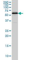 Anti-HDAC1 Mouse Monoclonal Antibody [clone: 5A11]