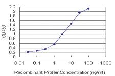 Anti-MLLT11 Mouse Monoclonal Antibody [clone: 2A9-1B7]