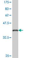 Anti-MSLN Mouse Polyclonal Antibody