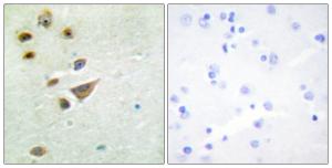 Immunohistochemical analysis of paraffin-embedded human brain tissue using Anti-NT5C3 Antibody. The right hand panel represents a negative control, where the antibody was pre-incubated with the immunising peptide.