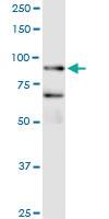 Anti-FBXO40 Polyclonal Antibody Pair