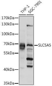 Western blot analysis of extracts of various cell lines, using Anti-Sodium Iodide Symporter Antibody (A12380) at 1:1,000 dilution. The secondary antibody was Goat Anti-Rabbit IgG H&L Antibody (HRP) at 1:10,000 dilution.