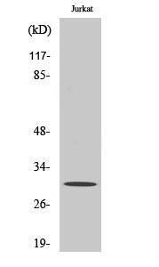 Western blot analysis of various cells using Anti-HOXD12 Antibody