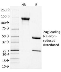 SDS-PAGE analysis of Anti-CD3 epsilon Antibody [C3e/1931] under non-reduced and reduced conditions; showing intact IgG and intact heavy and light chains, respectively. SDS-PAGE analysis confirms the integrity and purity of the Antibody