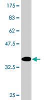 Anti-GNLY Mouse Monoclonal Antibody [clone: 2A6]