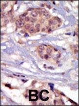 Anti-FYN Rabbit Polyclonal Antibody (PE (Phycoerythrin))