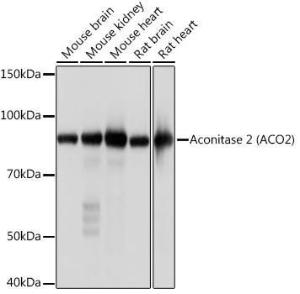 Western blot analysis of extracts of various cell lines, using Anti-Aconitase 2 Antibody [ARC1072] (A306968) at 1:1,000 dilution. The secondary antibody was Goat Anti-Rabbit IgG H&L Antibody (HRP) at 1:10,000 dilution.