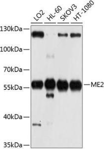 Western blot analysis of extracts of various cell lines, using Anti-ME2 Antibody (A12382) at 1:1000 dilution. The secondary Antibody was Goat Anti-Rabbit IgG H&L Antibody (HRP) at 1:10000 dilution. Lysates/proteins were present at 25 µg per lane