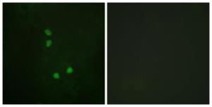 Immunofluorescence analysis of NIH/3T3 cells using Anti-Cyclin E2 (phospho Thr392) Antibody. The right hand panel represents a negative control, where the antibody was pre-incubated with the immunising peptide.