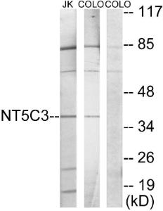 Western blot analysis of lysates from Jurkat and COLO205 cells using Anti-NT5C3 Antibody. The right hand lane represents a negative control, where the antibody is blocked by the immunising peptide.