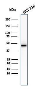 Western blot analysis of HCT116 cell lysate using Anti-Cytokeratin 8 Antibody [KRT8/2174R]