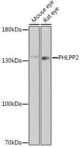 Western blot analysis of extracts of various cell lines, using Anti-PHLPP2 Antibody (A305647) at 1:1,000 dilution The secondary antibody was Goat Anti-Rabbit IgG H&L Antibody (HRP) at 1:10,000 dilution Lysates/proteins were present at 25 µg per lane