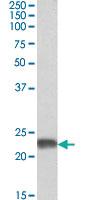 Anti-SOD2 Goat Polyclonal Antibody